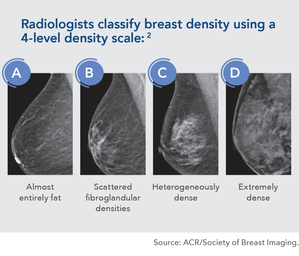 Cmdensity Mammogram Software Curemetrix Catch Cancers Early